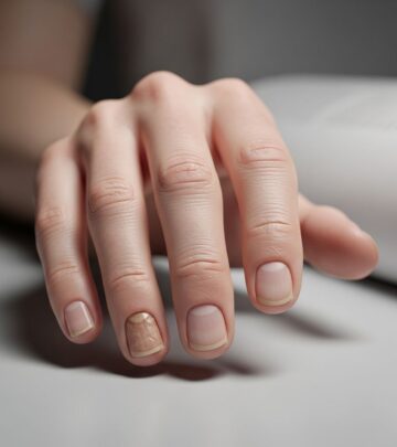 Understanding dyskeratosis congenita: A comprehensive guide to this rare genetic bone marrow disorder.